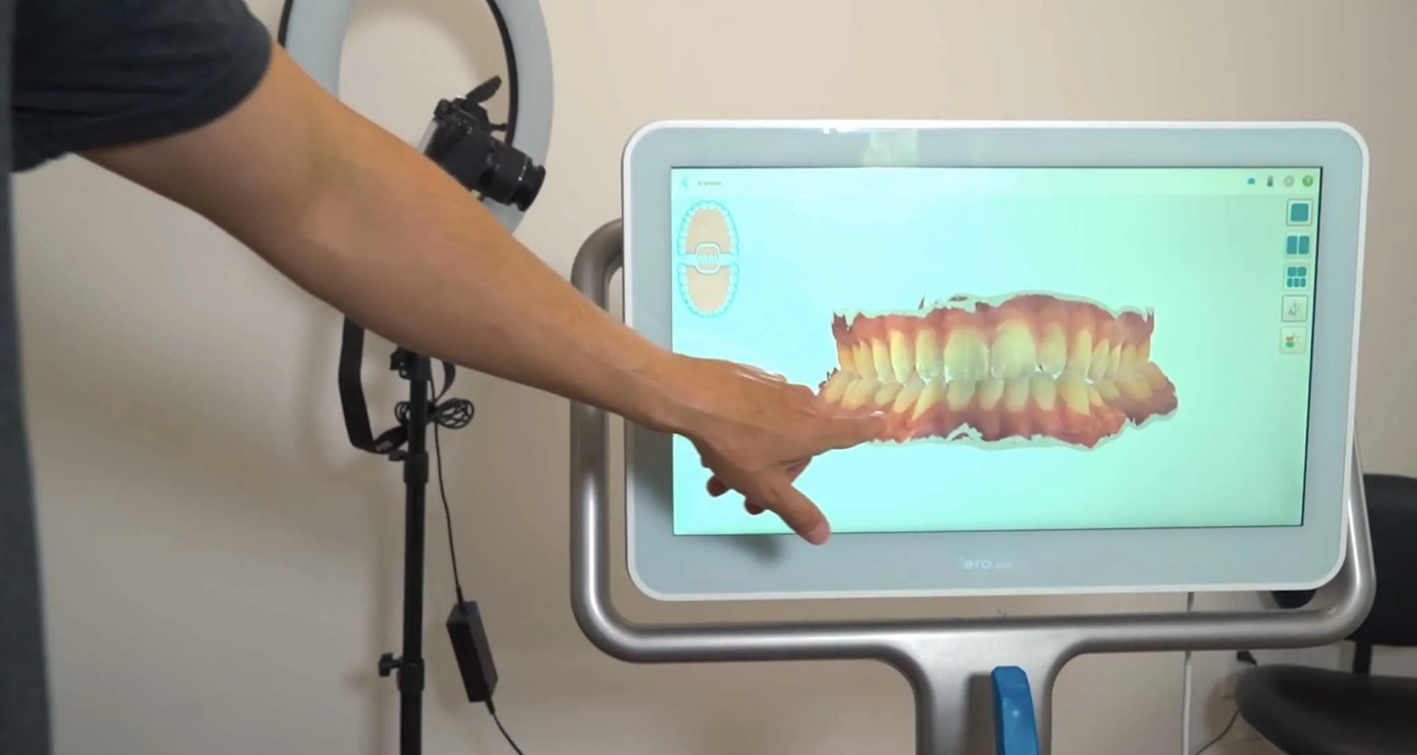 Invisalign San Marcos, CA